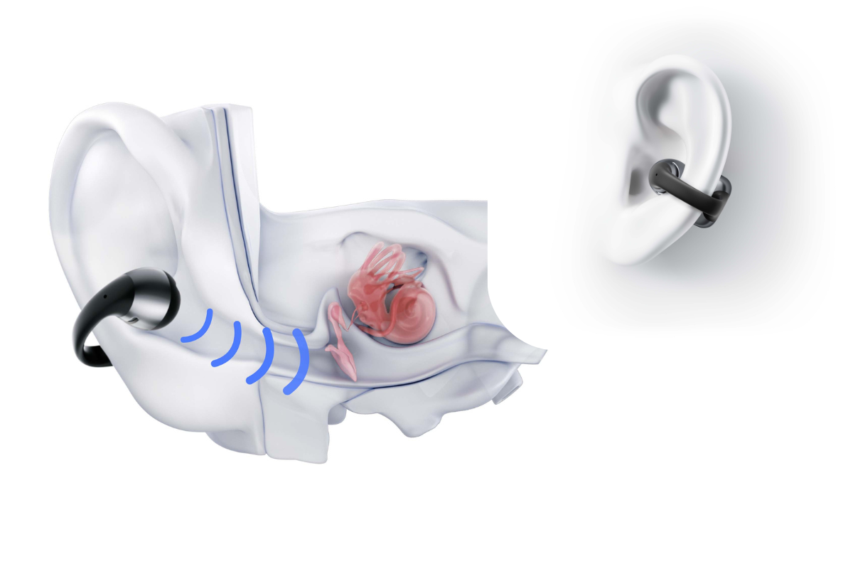 Shokz OpenDots ONE Klipsikiinnitteiset avoimet hybridikuulokkeet Dolby aanella ja 40 h akulla 2